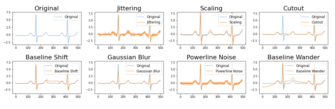 cinc21_ecg.png